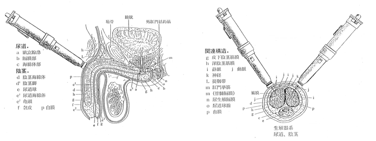 新・陰茎海綿体注射法（新・ICI療法）のイメージ図